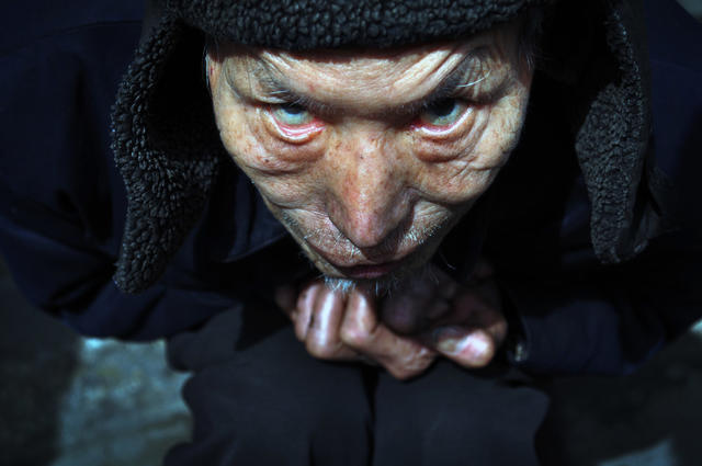 麻风村麻风病人