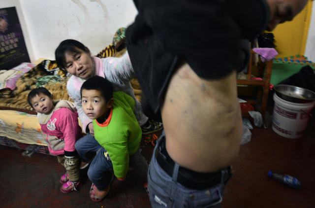 活在“脑瘫村”