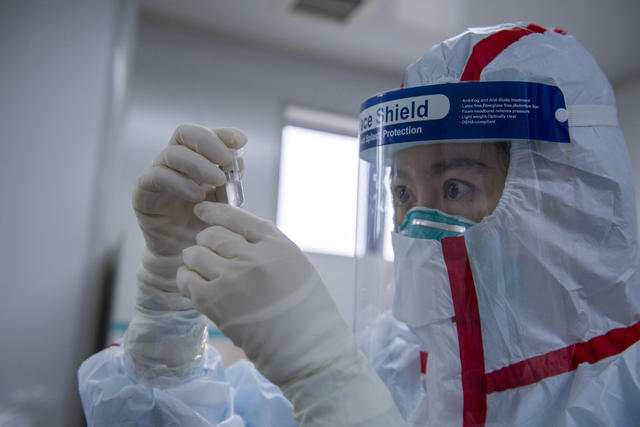 核酸检测 黄冈 湖南医疗队 疾控 科普 PCR 八联管 EP管
