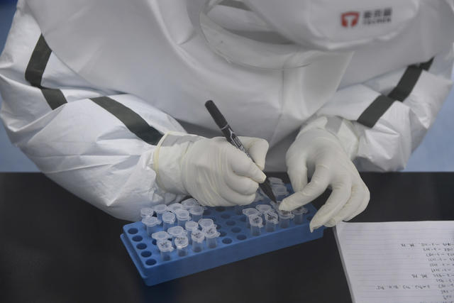 核酸检测 黄冈 湖南医疗队 疾控 科普 PCR 八联管 EP管
