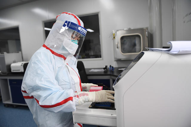 核酸检测 黄冈 湖南医疗队 疾控 科普 PCR 八联管 EP管
